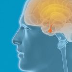 تومور هیپوفیز